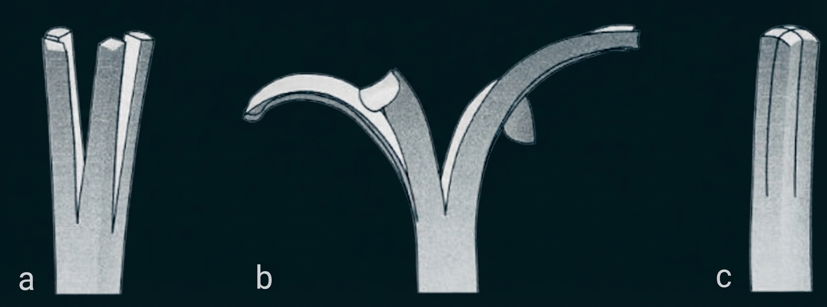 Drei schematische graustufige Darstellungen verzweigter Strukturen, beschriftet mit a, b und c.